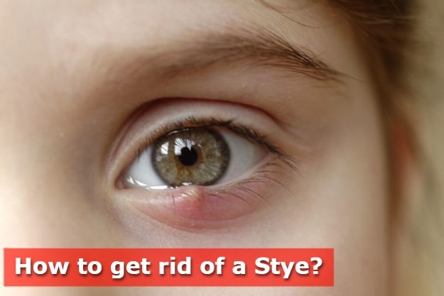 to get rid of a stye fast